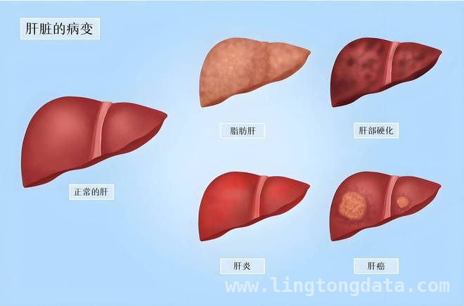 中西医结合助力，2025爱肝日守护肝脏远离硬化 爱肝刻不容缓！2025全国爱肝日聚焦中西医结合防硬化