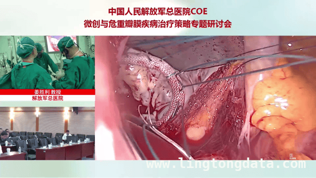 聚焦心脏瓣膜手术，这场研讨会带来创新与突破