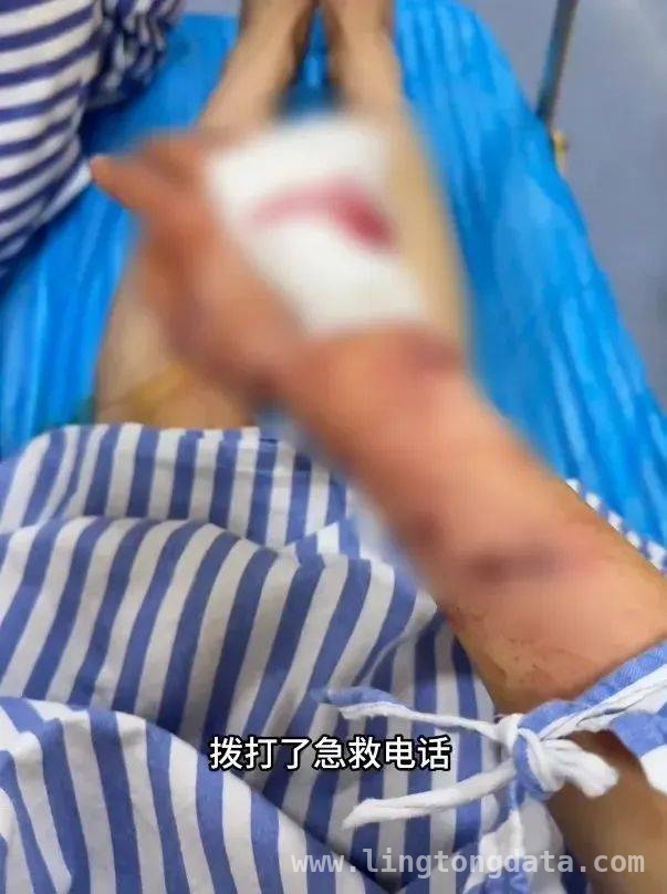 惊！女子家中洗澡，浴室玻璃门突然炸裂送她进医院，洗澡竟成“生死危机”，温州女子被浴室玻璃门割伤