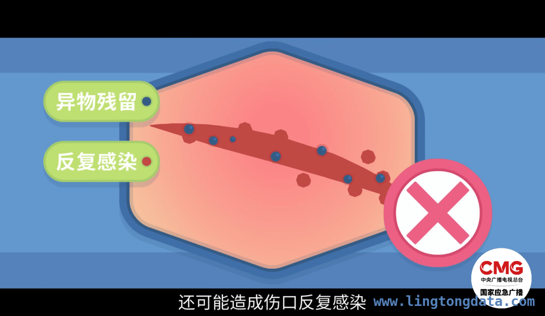 出租屋浴室惊魂：玻璃门炸裂女子受伤