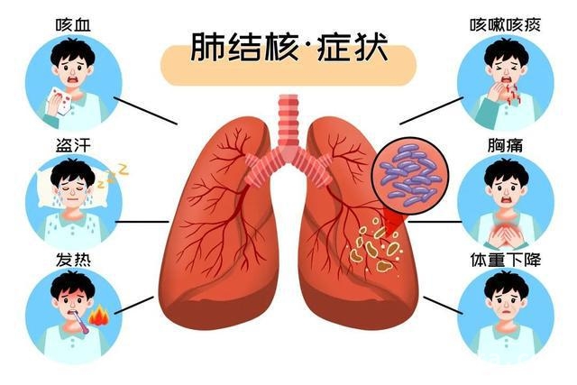 第30个世界防治结核病日，专家详解防治要点