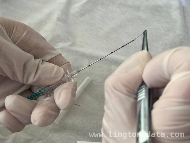 家门口的中医减肥法，社区卫生中心新选择