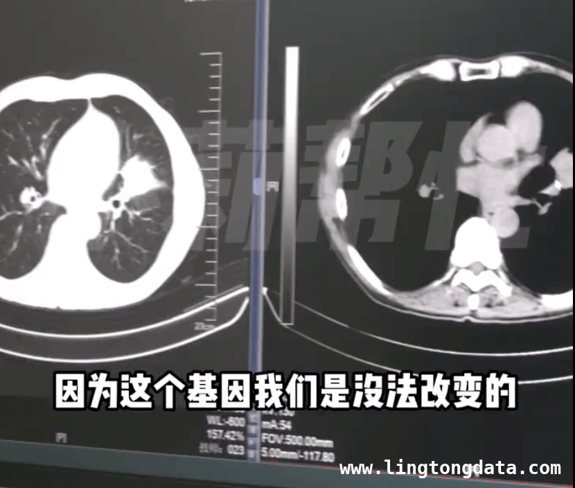9口之家8人患癌离世，癌症遗传真相大揭秘！