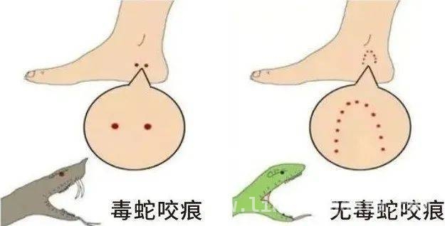 杭州气温回升蛇出动，遭遇蛇咬如何急救？看这里！，春日出行需警惕！杭州蛇出没，急救知识要掌握