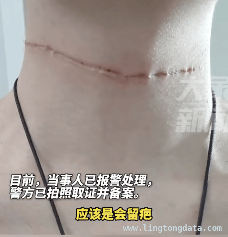 春季放风筝热背后：隐形风筝线暗藏致命危险，春季放风筝需谨慎，风筝线割伤多人引关注