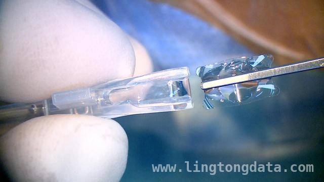 国产“龙晶”闪耀深圳，爱尔眼科引领屈光技术革新，深圳首例国产“龙晶”晶体植入，开启近视矫正新时代