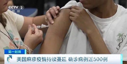 美国麻疹大爆发，得州疫情最为严重，美国麻疹疫情肆虐，病例数激增！