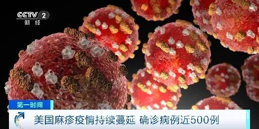 美国麻疹大爆发，得州疫情最为严重，美国麻疹疫情肆虐，病例数激增！