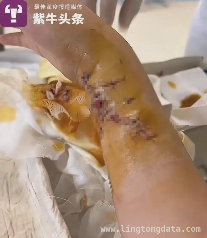 女子美人鱼大赛训练遭鲨鱼咬伤，法院判决引争议，女子美人鱼训练遇鲨灾，责任划分引当事人不满