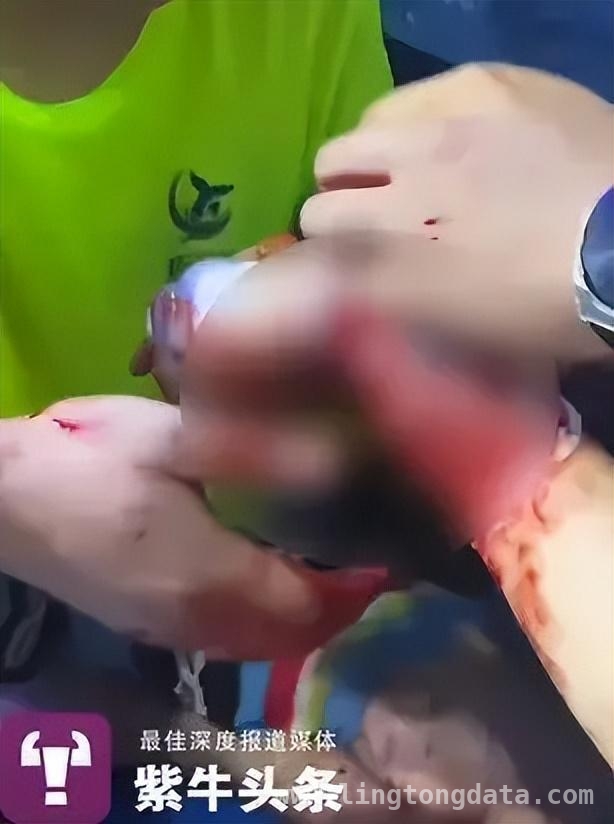 女子美人鱼大赛训练遭鲨鱼咬伤，法院判决引争议，女子美人鱼训练遇鲨灾，责任划分引当事人不满