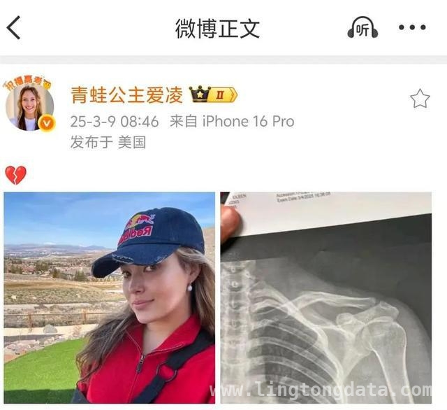 谷爱凌受伤后首晒照，伤病之下仍盼重返赛场，伤病难挡梦想！谷爱凌受伤后亮相，米兰冬奥会仍有希望