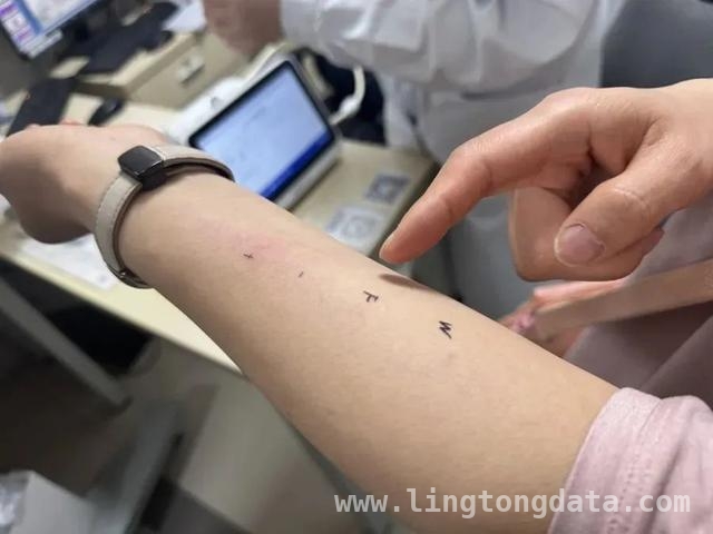 从过敏案例看：如何躲开过敏原，守护健康？，警惕！过敏可能在几小时内致命