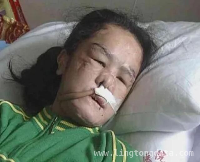 珠海保姆受虐案：恶魔雇主的暴行与行业的觉醒，200元月薪，15岁蔡敏敏五年保姆生涯的血色悲歌